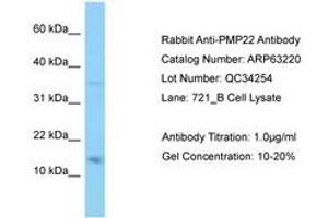 Image no. 1 for anti-Peripheral Myelin Protein 22 (PMP22) (AA 27-76) antibody (ABIN6749963) (PMP22 Antikörper  (AA 27-76))