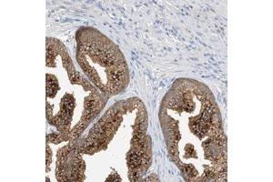 Immunohistochemical staining (Formalin-fixed paraffin-embedded sections) of human prostate with C3orf39 polyclonal antibody  shows strong cytoplasmic positivity in glandular cells. (C3orf39 Antikörper)