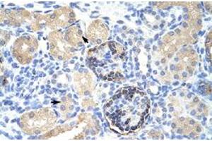 Immunohistochemical staining (Formalin-fixed paraffin-embedded sections) of human kidney with CLIC5 polyclonal antibody  at 4-8 ug/mL working concentration. (CLIC5 Antikörper  (C-Term))