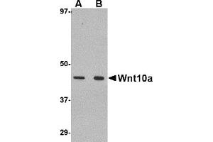 Western Blotting (WB) image for anti-Wingless-Type MMTV Integration Site Family, Member 10A (WNT10A) (C-Term) antibody (ABIN1030803) (WNT10A Antikörper  (C-Term))