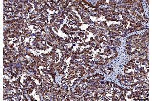 IHC analysis of CD147/Emmprin using anti-CD147/Emmprin antibody (ABIN7599998). (CD147 Antikörper  (AA 138-323))