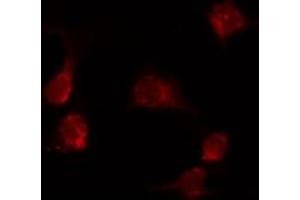 Immunofluorescence (fixed cells) (IF/ICC) image for anti-KDEL (Lys-Asp-Glu-Leu) Endoplasmic Reticulum Protein Retention Receptor 1 (KDELR1) (Internal Region) antibody (ABIN6262763)