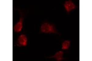 ABIN6274020 staining MCF7 by IF/ICC.