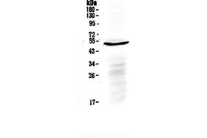 Western blot analysis of IL6R using anti-IL6R antibody . (IL-6 Receptor Antikörper  (C-Term))