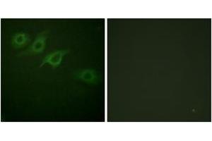 Immunofluorescence analysis of HepG2 cells, using Interferon-gamma Receptor alpha chain (Ab-457) Antibody. (IFNGR1 Antikörper  (AA 431-480))