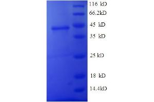 SDS-PAGE (SDS) image for Junctional Adhesion Molecule 2 (JAM2) (AA 29-238), (Extracellular) protein (His tag) (ABIN4974246) (JAM2 Protein (AA 29-238, Extracellular) (His tag))