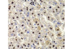 Immunohistochemistry of paraffin-embedded Rat liver using HIRIP3 Polyclonal Antibody at dilution of 1:100 (40x lens). (HIRIP3 Antikörper)