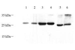 Western blot analysis of HOXD12 (ABIN7074252) at dilution of 1: 500 (HOXD12 Antikörper)