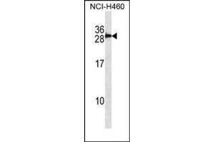 Western blot analysis in NCI-H460 cell line lysates (35 ug/lane) using S100B Antibody (Center) Cat. (S100B Antikörper  (Middle Region))