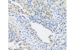 Immunohistochemistry of paraffin-embedded Rat ovary using C12orf10 Polyclonal Antibody at dilution of 1:100 (40x lens). (C12orf10 Antikörper)