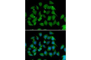 Immunofluorescence analysis of HeLa cell using FMO1 antibody. (FMO1 Antikörper)
