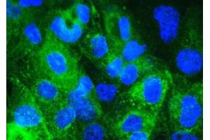 IF analysis of Beta 2 Microglobulin using anti- Beta 2 Microglobulin antibody (ABIN5518810). (beta-2 Microglobulin Antikörper  (AA 22-119))
