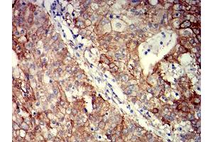 Immunohistochemistry (IHC) image for anti-Integrin beta 4 (ITGB4) (AA 29-206) antibody (ABIN5611134)