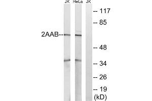 Western blot analysis of extracts from Jurkat cells and HeLa cells, using PPP2R1B antibody. (PPP2R1B Antikörper  (C-Term))