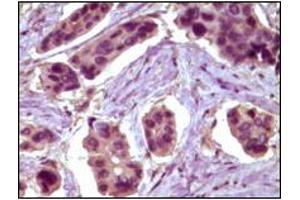 Immunohistochemistry (IHC) image for anti-B-Cell CLL/lymphoma 10 (BCL10) antibody (ABIN2464015) (BCL10 Antikörper)