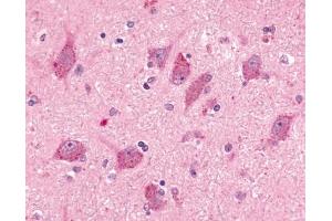 Immunohistochemical staining of human brain, neurons and glia (BAI2 Antikörper  (N-Term))