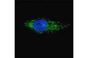 Fluorescent image of Chloroquine treated U251 cells (50 uM, 16h) stained with LC3A antibody.