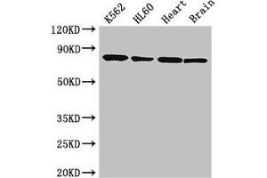 Western Blot Positive WB detected in: K562 whole cell lysate, HL60 whole cell lysate, Mouse heart tissue, Mouse brain tissue All lanes: BTK antibody at 3. (BTK Antikörper  (AA 254-443))