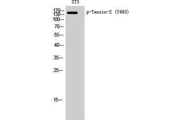 TENC1 Antikörper  (pTyr483)