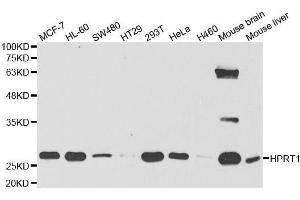 Western blot analysis of extracts of various cell lines, using HPRT1 antibody. (HPRT1 Antikörper  (AA 1-218))