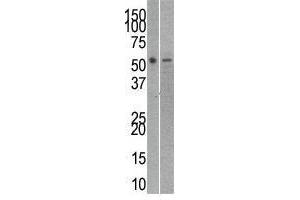 Image no. 1 for anti-RuvB-Like 2 (E. Coli) (RUVBL2) (C-Term) antibody (ABIN357238) (RUVBL2 Antikörper  (C-Term))