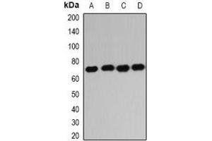Western blot analysis of IGF2BP1 expression in HL60 (A), K562 (B), NIH3T3 (C), mouse liver (D) whole cell lysates. (IGF2BP1 Antikörper)