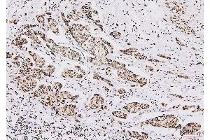 IHC analysis of NRF1 using anti-NRF1 antibody (ABIN7600874). (NRF1 Antikörper  (AA 246-503))