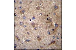 Immunohistochemistry (Paraffin-embedded Sections) (IHC (p)) image for anti-serpin Peptidase Inhibitor, Clade E (Nexin, Plasminogen Activator Inhibitor Type 1), Member 2 (SERPINE2) (AA 105-136), (Middle Region) antibody (ABIN954749)