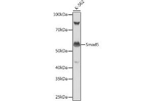 Western blot analysis of extracts of K-562 cells, using Smad5 antibody (ABIN7270354) at 1:1000 dilution.