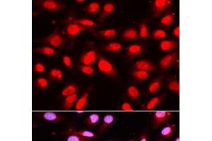 Immunofluorescence analysis of U2OS cells using U2AF2 Polyclonal Antibody (U2AF2 Antikörper)