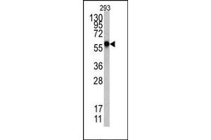 Image no. 1 for anti-Heat Shock Factor Protein 1 (HSF1) (Sumoylation Site) antibody (ABIN357730) (HSF1 Antikörper  (Sumoylation Site))
