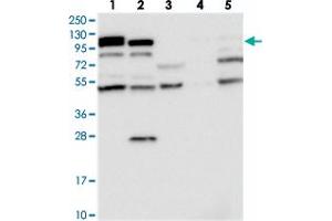 Western blot analysis of Lane 1: RT-4, Lane 2: U-251 MG, Lane 3: Human Plasma, Lane 4: Liver, Lane 5: Tonsil with OAS3 polyclonal antibody  at 1:250-1:500 dilution. (OAS3 Antikörper)