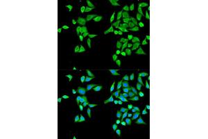 Immunofluorescence analysis of MCF-7 cell using CES2 antibody. (CES2 Antikörper  (AA 310-410))