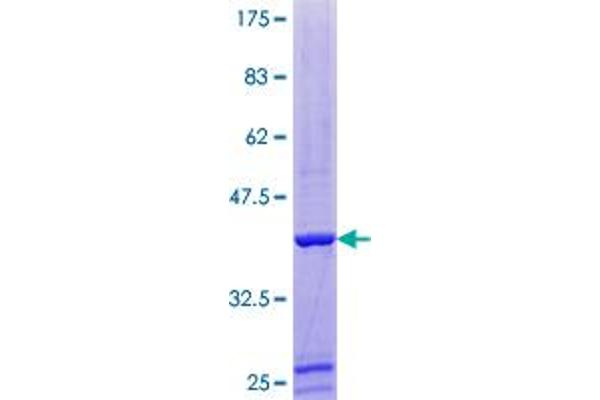 Profilin 4 Protein (PFN4) (AA 1-129) (GST tag)