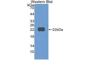 Western Blotting (WB) image for anti-Cylindromatosis (Turban Tumor Syndrome) (CYLD) (AA 170-338) antibody (ABIN3205178) (CYLD Antikörper  (AA 170-338))