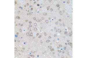 Immunohistochemistry of paraffin-embedded rat brain using UBE2A antibody. (UBE2A Antikörper)
