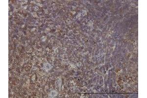 Image no. 1 for anti-Ribosomal Protein L9 (RPL9) (AA 93-192) antibody (ABIN598584) (RPL9 Antikörper  (AA 93-192))