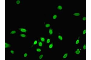 Immunofluorescent analysis of Hela cells using ABIN7143861 at dilution of 1:100 and Alexa Fluor 488-congugated AffiniPure Goat Anti-Rabbit IgG(H+L) (Ensa Antikörper  (AA 1-121))