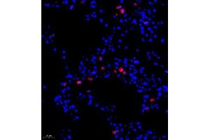 Immunofluorescence of paraffin embedded rat lung using ADI1 (ABIN7072888) at dilution of 1:1200 (400x lens)