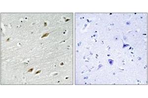 Immunohistochemistry analysis of paraffin-embedded human brain tissue, using FKHR (Ab-319) Antibody. (FOXO1 Antikörper  (AA 286-335))