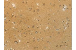 The image on the left is immunohistochemistry of paraffin-embedded Human brain tissue using ABIN7192532(SLC9A3 Antibody) at dilution 1/20, on the right is treated with synthetic peptide. (SLC9A3 Antikörper)
