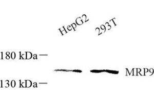 Western blot analysis of ABCC12 (ABIN7073147) at dilution of 1: 600 (ABCC12 Antikörper)