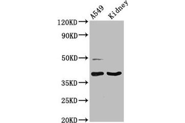 LGALS12 Antikörper  (AA 1-336)