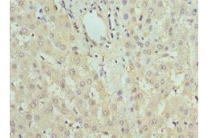 Immunohistochemistry of paraffin-embedded human liver tissue using ABIN7153202 at dilution of 1:100 (FBP1 Antikörper  (AA 1-338))
