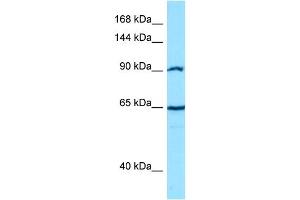 Host: Rabbit Target Name: CTNNA2 Sample Type: PANC1 Whole cell lysates Antibody Dilution: 1. (CTNNA2 Antikörper  (C-Term))