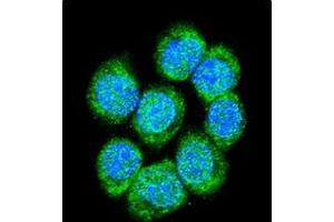 Confocal immunofluorescent analysis of Catenin beta-1 Antibody (C-term) Cat. (CTNNB1 Antikörper  (C-Term))