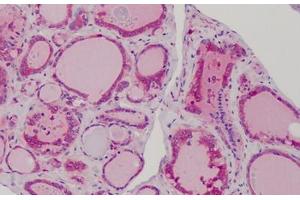 Human Thyroid: Formalin-Fixed, Paraffin-Embedded (FFPE) (MAD2L1 Antikörper  (AA 1-174))
