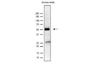 Western Blotting (WB) image for anti-Izumo Sperm-Egg Fusion 1 (IZUMO1) antibody (ABIN2452040)