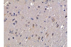 ABIN6258776 and ABIN6273504 at 1/100 staining rat brain tissue by IHC-P.