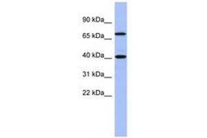 Image no. 1 for anti-SLAIN Motif Family, Member 2 (SLAIN2) (AA 71-120) antibody (ABIN6743288) (SLAIN2 Antikörper  (AA 71-120))